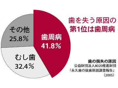 歯を失う原因の第1位です